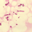 Malassezia globosa CBS 7966 (GCA_000181695)